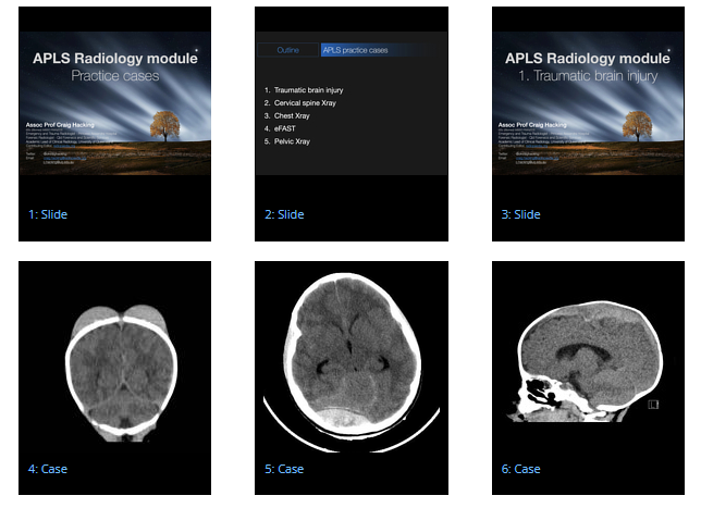 Radiology - Radiopaedia screengrab